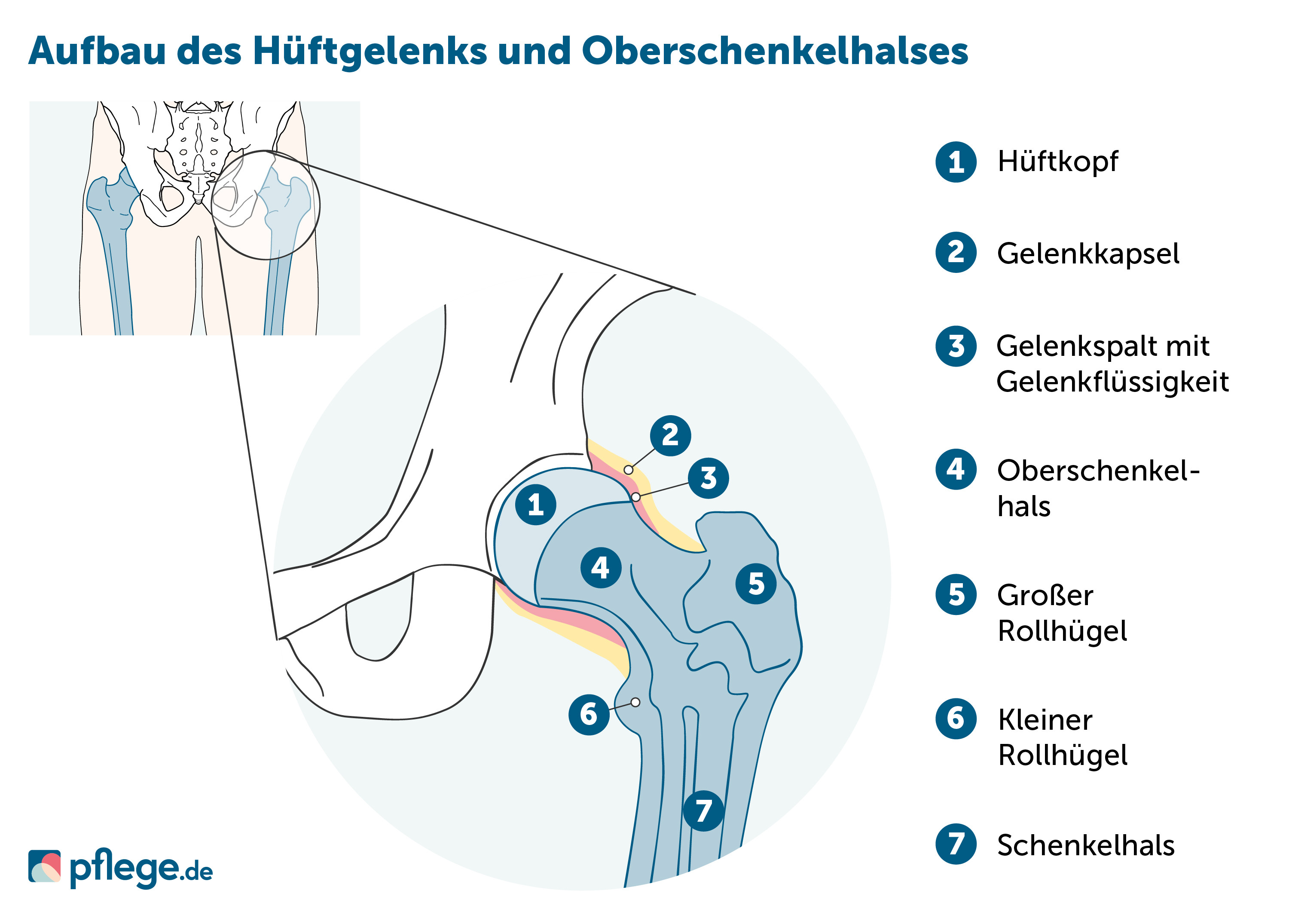 Aufbau des Hüftgelenks und Oberschenkelhalses