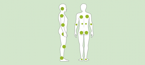 Dekubitus Grad 1, 2, 3, 4 » Dekubitus Stadien, Grade & Kategorien