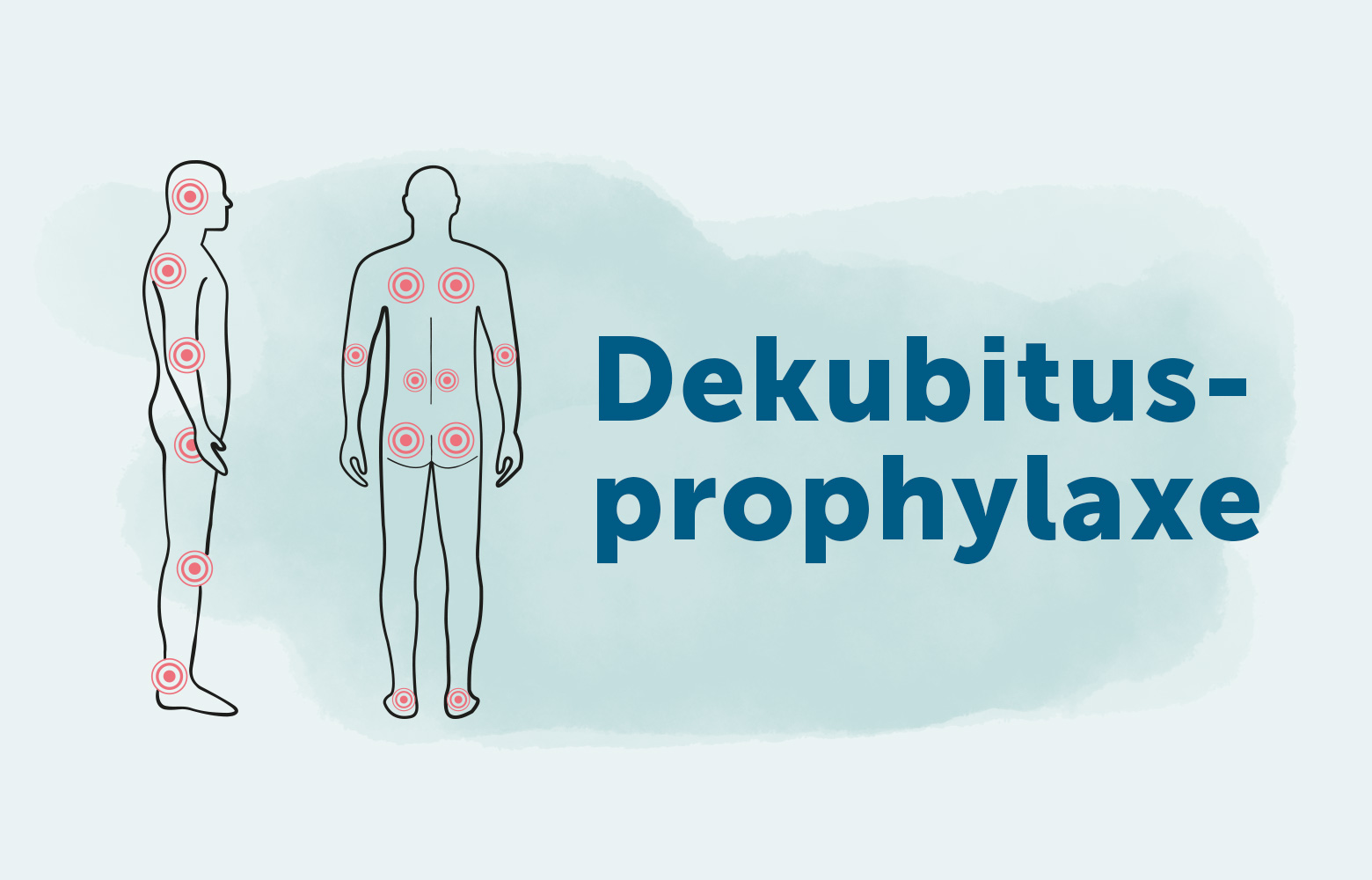 Dekubitusprophylaxe » Expertenstandard & Maßnahmen gegen Dekubitus