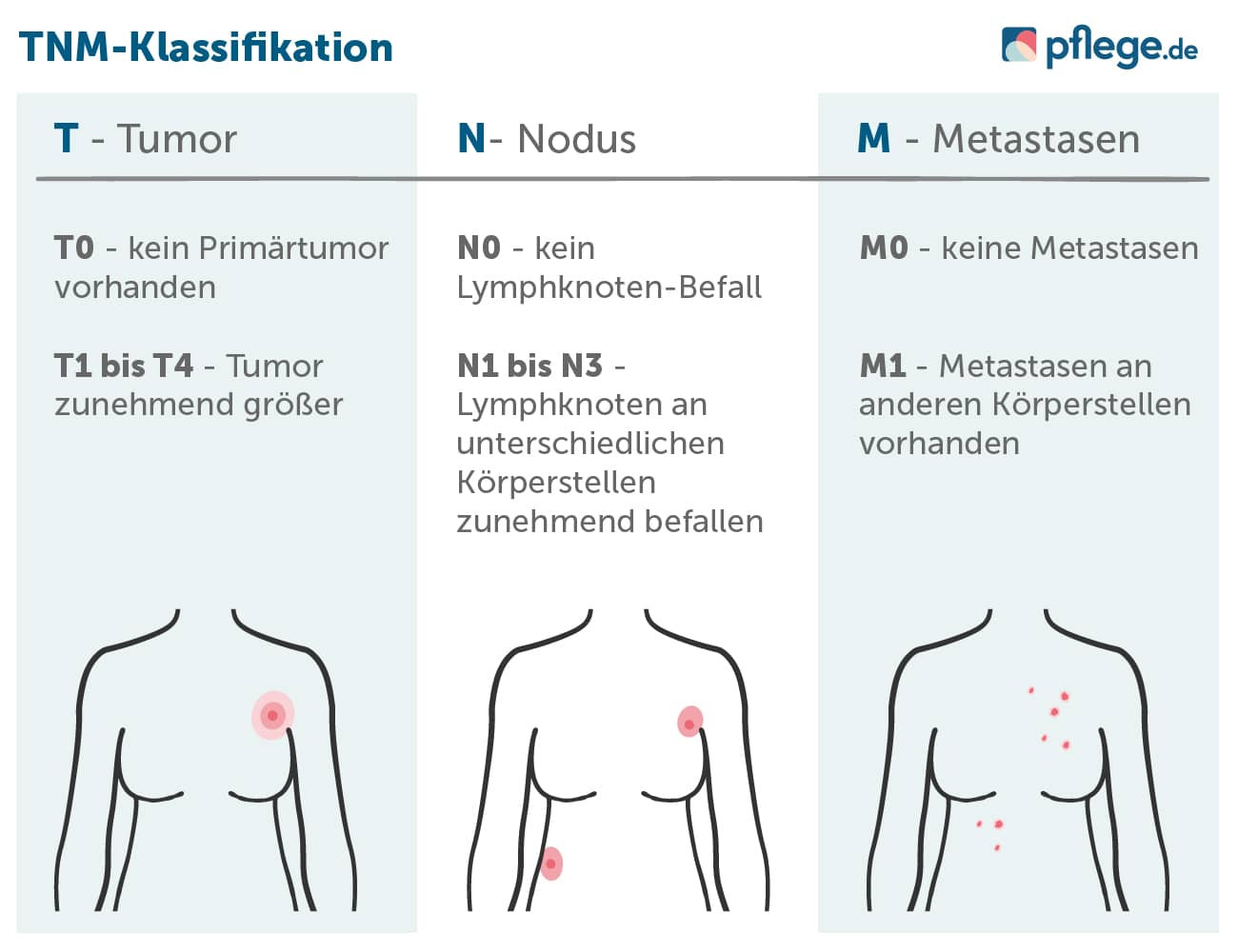 Krebsstadien nach TNM-Klassifikation Tabelle