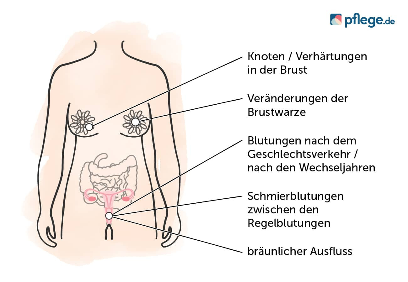 Mögliche Anzeichen für eine Krebserkrankung im weiblichen Körper