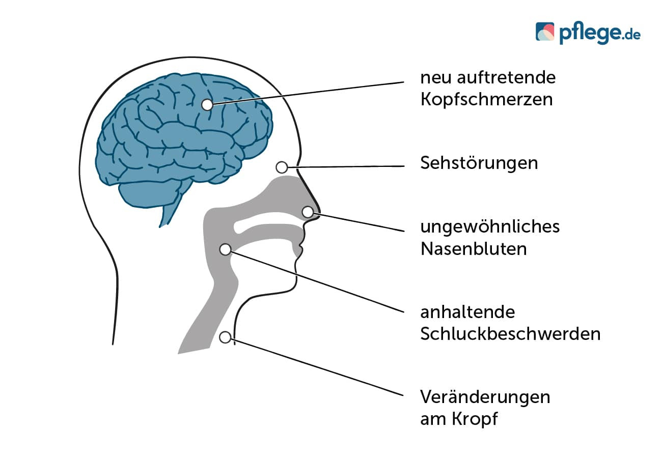 Mögliche Krebssymptome an Hals und Kopf