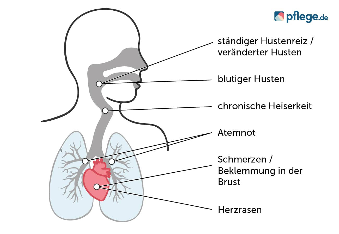 Mögliche Anzeichen für eine Krebserkrankung in den Atemwegen