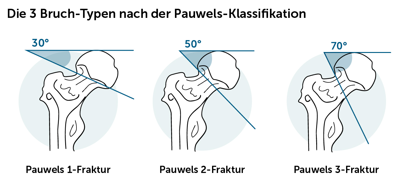 pflanztopf 70 cm hoch Mein-Pflanztopf.de GEMMA Design-Pflanzkbel 3XL 80 cm Pflanzgef Hhe 70  cm Frost UV-bestndig