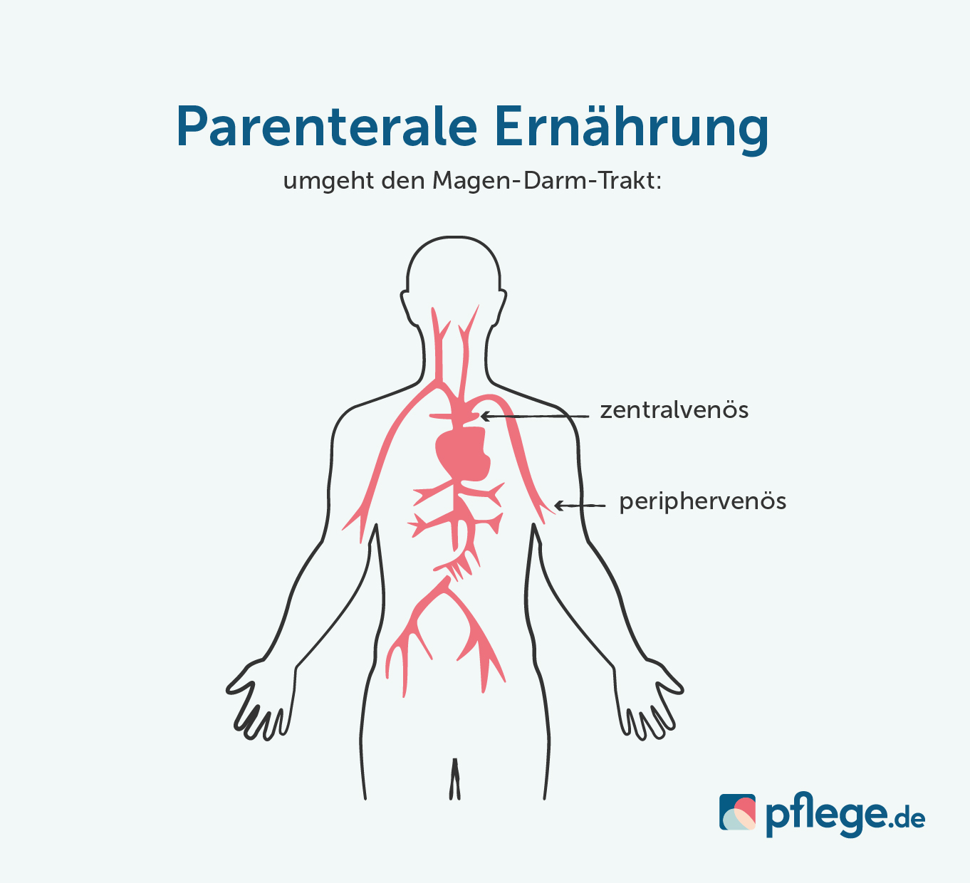 Parenterale Ernährung » Applikation & Produkte | Pflege.de