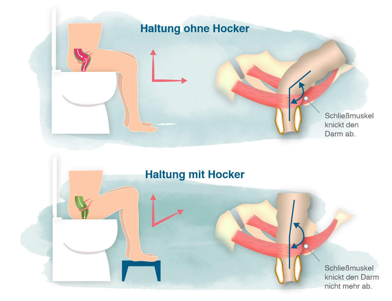 Toilettenhocker