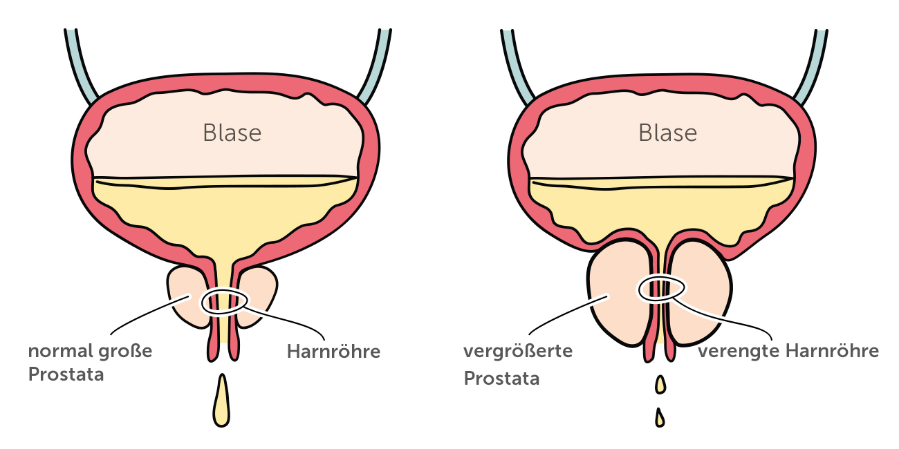 prostata befriedigen The 4 Best Anal Toys of 2026 main image 0